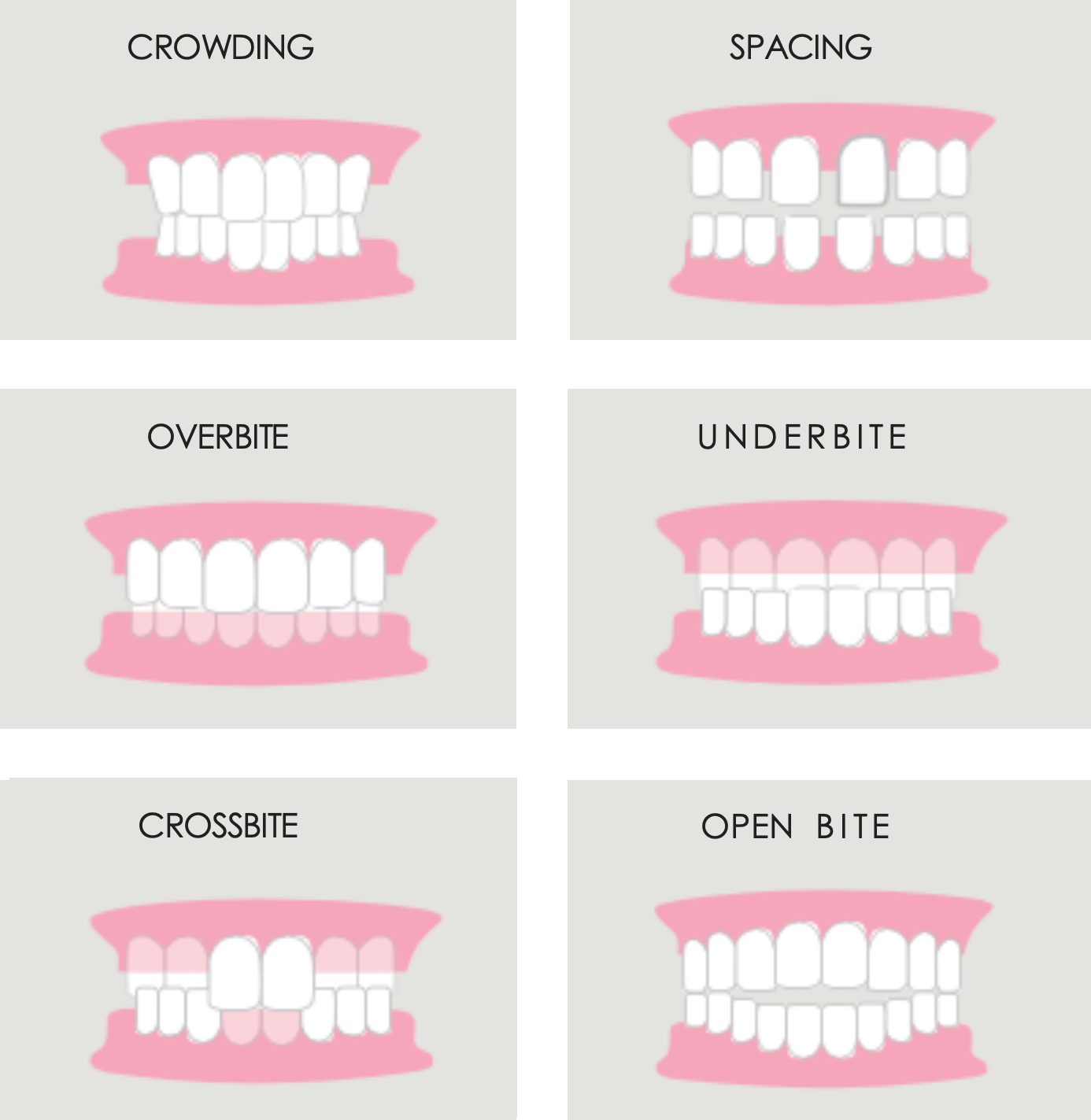 Smilers Teeth Chart